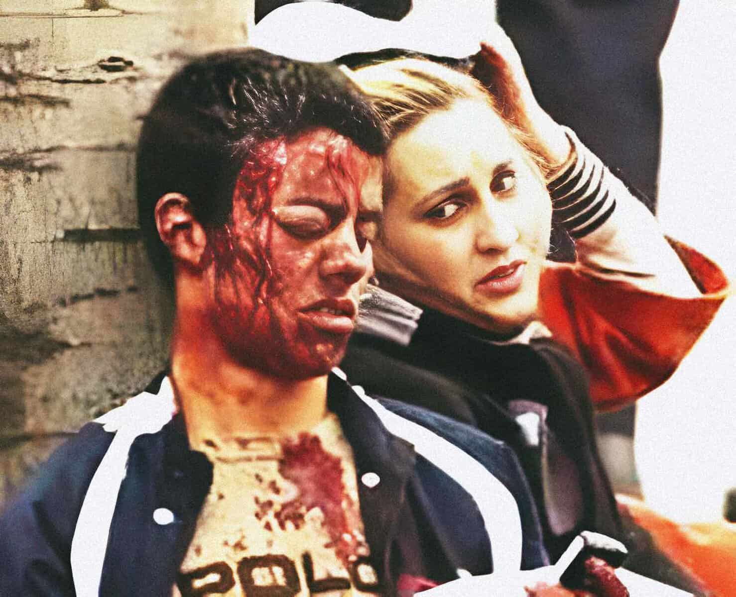 Burnt victim with facial injuries from a violent incident, with a woman looking distressed beside her, against a brick wall background.